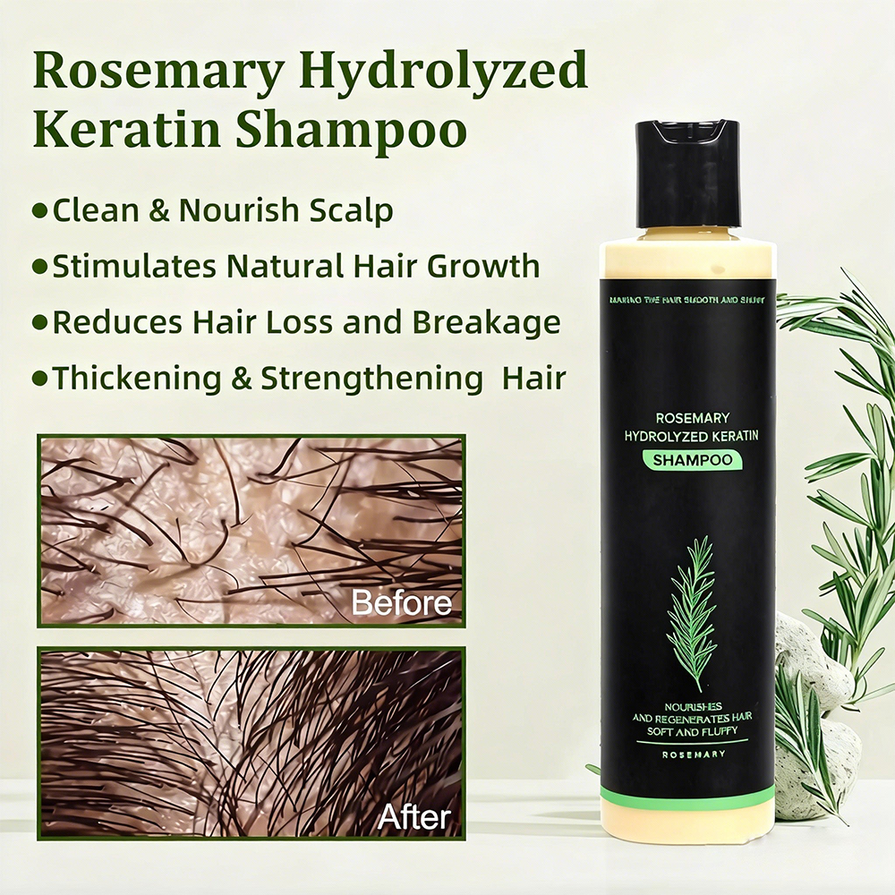 Last Day Buy 2 Get 1 Free🔥-Organic Rosemary Hair Growth Shampoo
