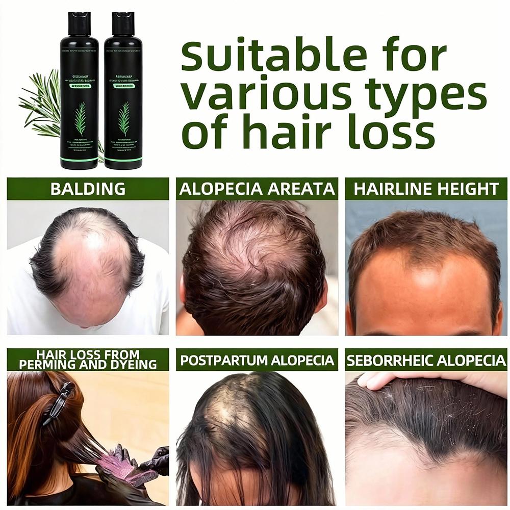 Last Day Buy 2 Get 1 Free🔥-Organic Rosemary Hair Growth Shampoo