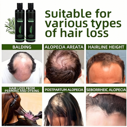 Last Day Buy 2 Get 1 Free🔥-Organic Rosemary Hair Growth Shampoo
