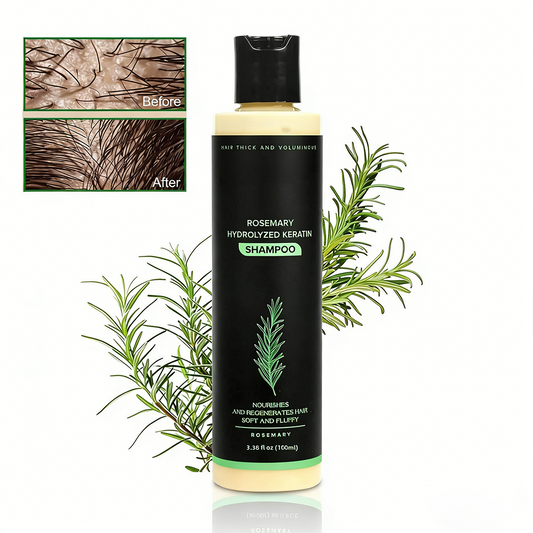 Last Day Buy 2 Get 1 Free🔥-Organic Rosemary Hair Growth Shampoo